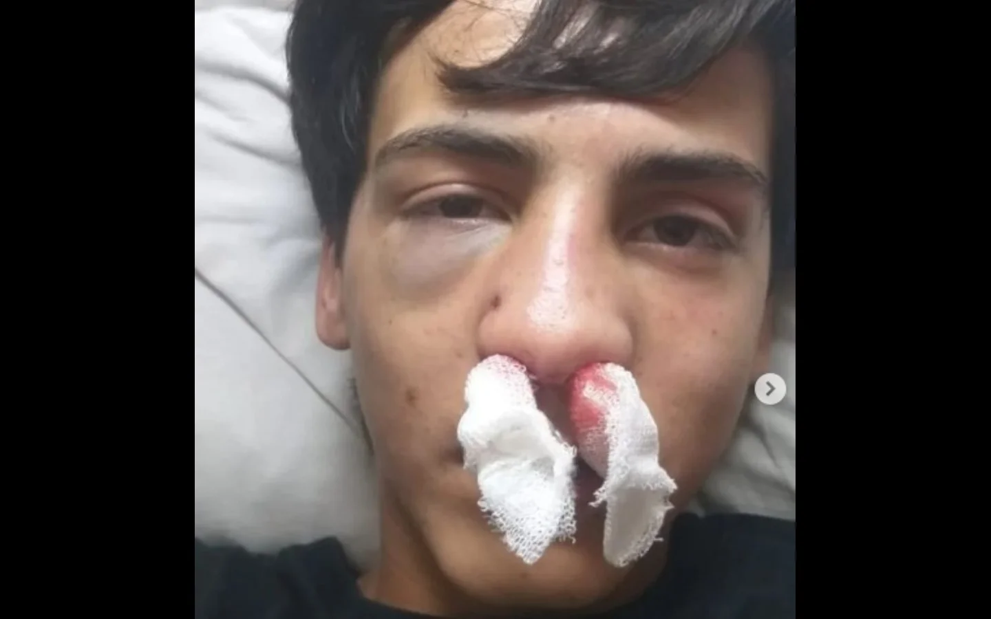 golpeado