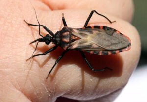 chagas