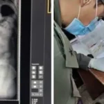 Detuvieron a tres hombres que viajaban a Mendoza con más de 250 cápsulas de cocaína en el cuerpo