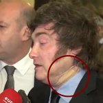 El Gobierno explicó por qué Javier Milei apareció con una venda en el cuello durante su viaje a España